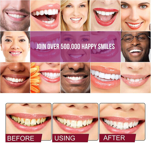 Sp-4 Probiotics Whitening Toothpaste Brightening 1
