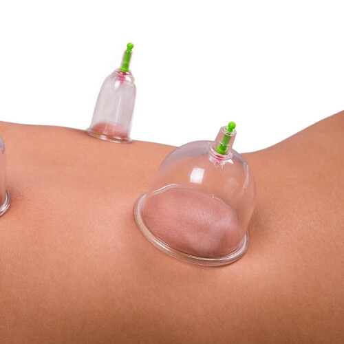 Cupping Set Professional Chinese Acupoint Cupping Massage Set 12 Cups 1
