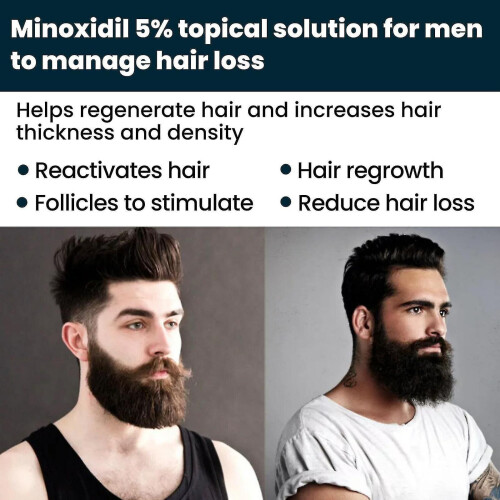 Hair Regrowth 5% Extra Strength Topical Hair Loss For Men Solution 1