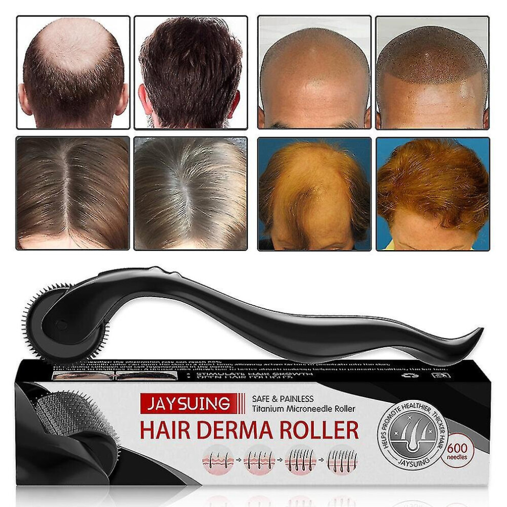Hair Derma Roller 600 Titanium Micro Needles Roller Hair Regeneration Growth Scalp Massager