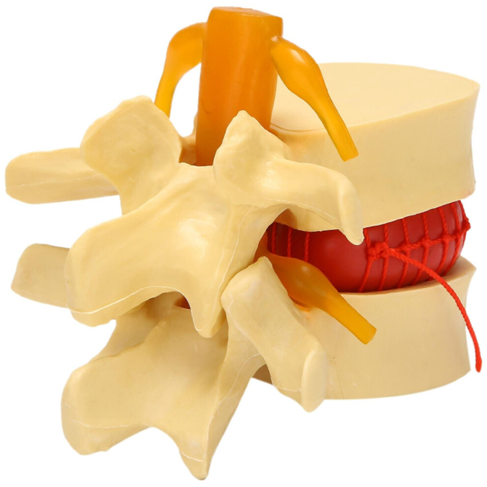 Lumbar Vertebrae Model Anatomical Lumbar Disc Herniation Anatomy Teaching Tool Lumbar Vertebrae Mod