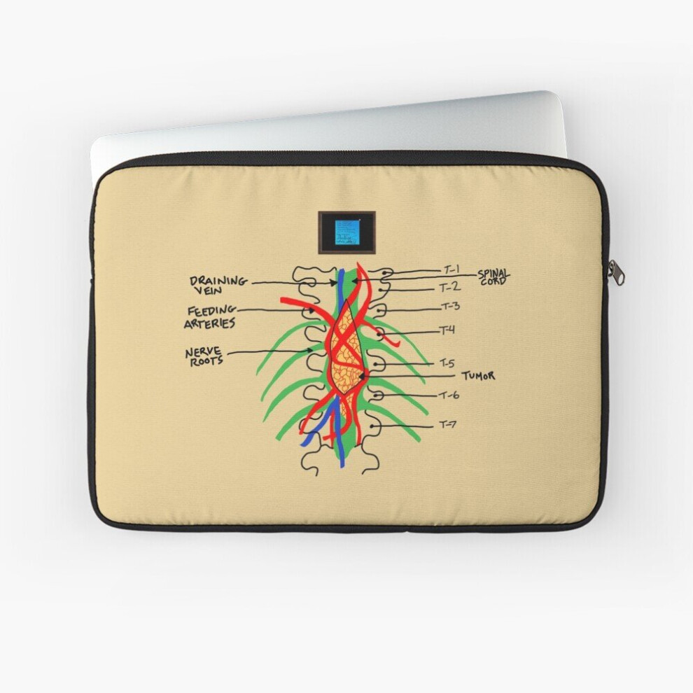 Laptop Sleeve This Is Forever 10 12 13 15 17 Inch Case Notebook Tablet Carrying Bag Cover 7802738413342