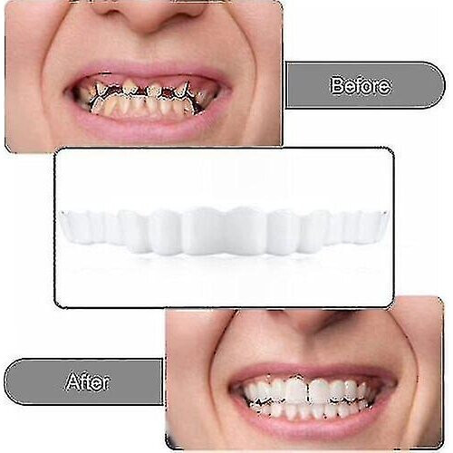 Smile Snap On False Teeth Upper Lower Dental Veneers Dentures Tooth Cover Set 2