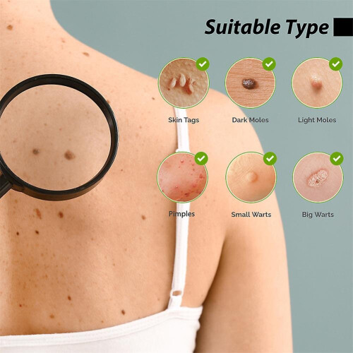 Mole 2