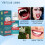 Teeth Glue Tooth Repair Kit Moldable Tooth Broken Teeth Gaps Repair 3