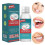 Teeth Glue Tooth Repair Kit Moldable Tooth Broken Teeth Gaps Repair 1