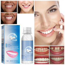 Moldable False Teeth Tooth Repair Granules, Teeth Repair Kit, Diy Temporary Tooth Repair Beads