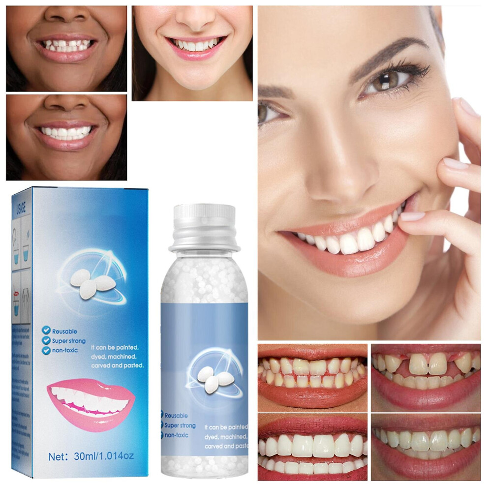 Moldable False Teeth Tooth Repair Granules, Teeth Repair Kit, Diy Temporary Tooth Repair Beads