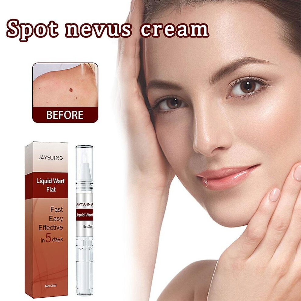 Skin Tag Mole Wart Liquid Flat Remover Pen Eliminate Foot Corn Nevus Removal Pens