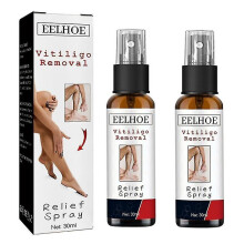 2x Vitiligo Removal Relief Spray Repair White Spot Desalination Sweat Spot Moisturizing