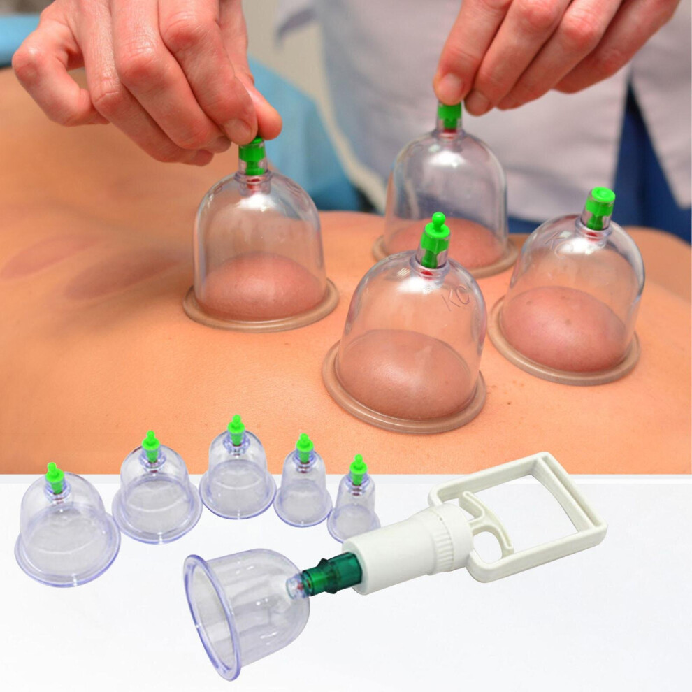 Cupping Device