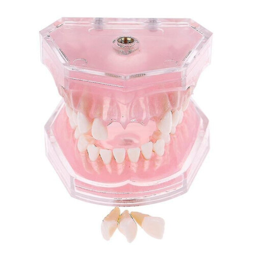 Dental Orthodontic Typodont Plastic Standard Model 4004 With 28 Removeable Teeth