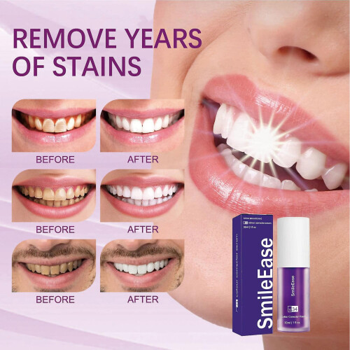 1pc, White Teeth Toothpaste V34 Purple Bottle 1