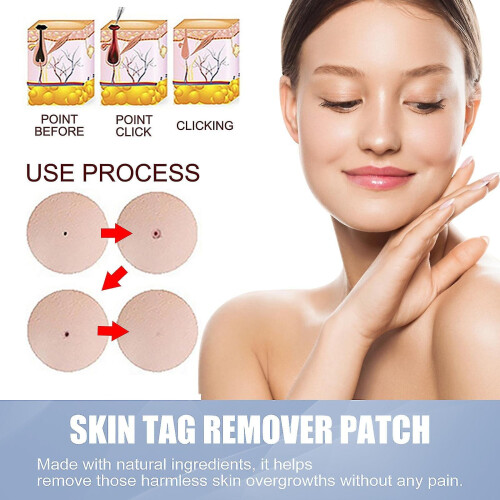 Skin Tag Remover Patches Quick Effective Mole Wart Removal Pad Sticker 144pcs 2