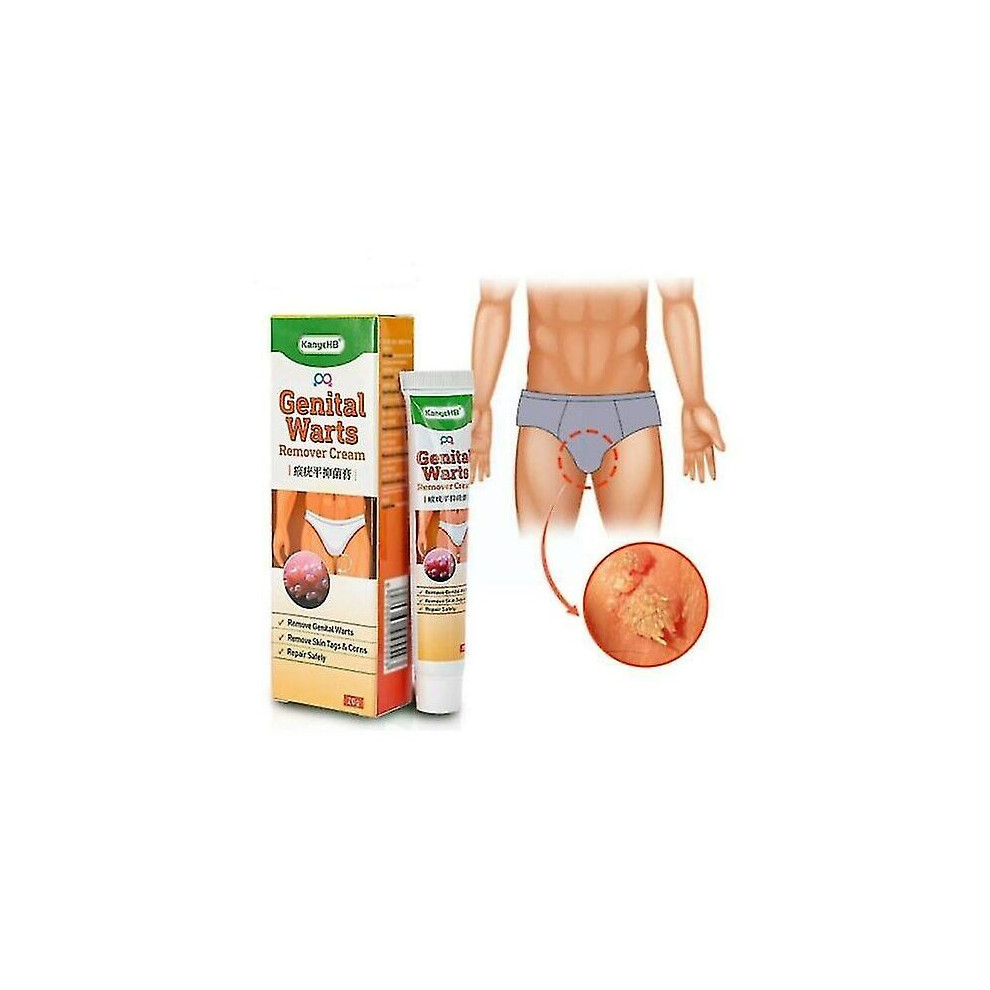 Wart Remover Ointment Vulva Herpes Genital Wart Condyloma Acuminatum Skin Tag Remover