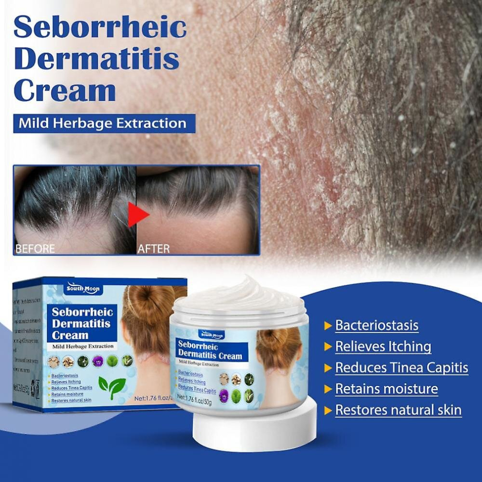 Seborrheic Skin Cream Head Acne Pruritus Scalp Ringworm Skin Problem Repair