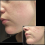 Adjustable Microneedle Derma Stamp For Hair Growth 4