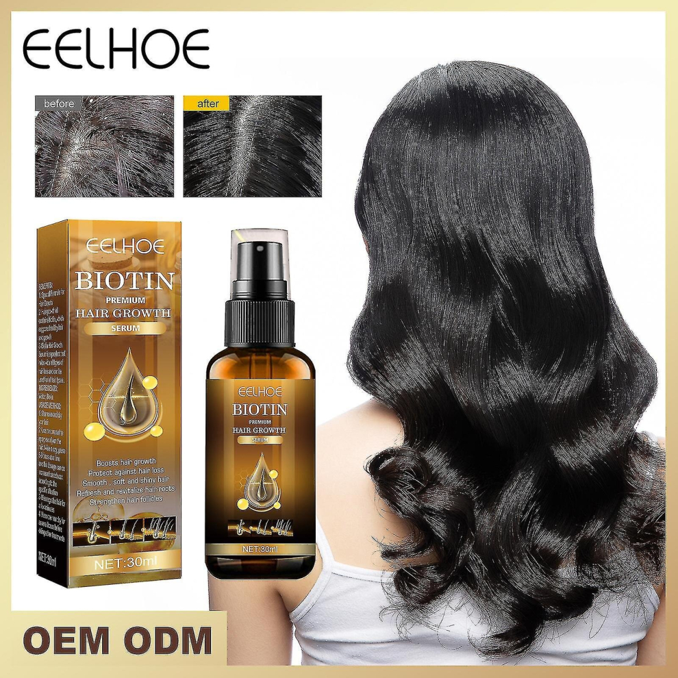 Biotin Hair Growth Anti Hair Loss Spray Fast Growing Hair Scalp Treatment-unisex