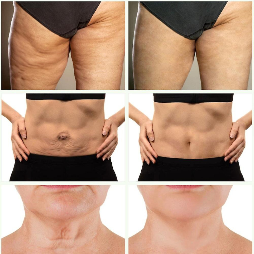 2pcs Anti Aging Cellulite Body Cream Collagen Improve Sagging Skin Remove Wrinkle