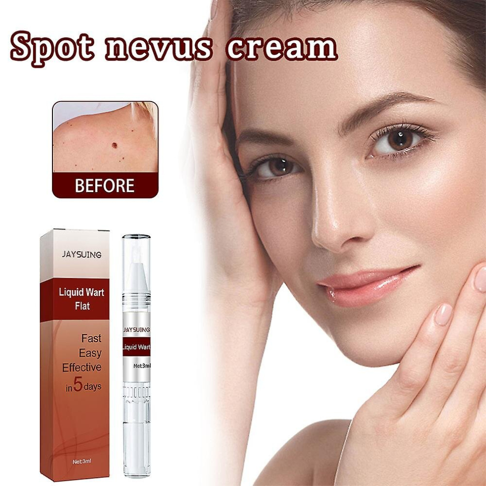 Skin Tag Mole Wart Liquid Flat Remover Pen Eliminate Foot Corn Nevus Removal Pens