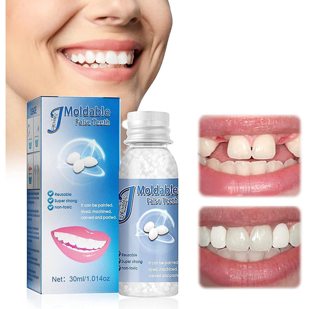 Moldable False Teeth Tooth Repair Granules, Teeth Repair Kit, Diy Temporary Tooth Repair Beads