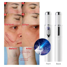 Blue Light Therapy Pen For Spider Veins Acne Removal Pen Scar Wrinkles Puffy Eyes Dark Circles Removal Pen