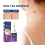 Hpv Remover  Wart Remover  Fast-acting 3