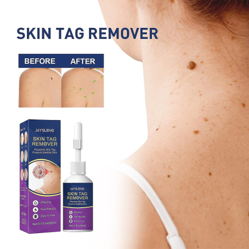 Hpv Remover  Wart Remover  Fast-acting 2