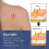 Hpv Remover  Wart Remover  Fast-acting 4