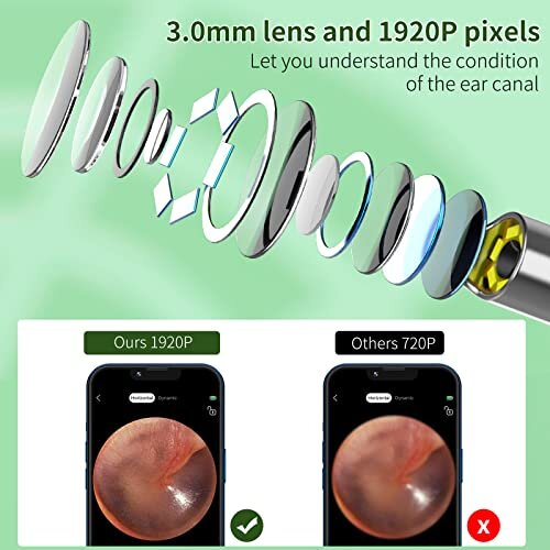 VITCOCO 1920P Ear Camera Otoscope – 6 LED, 3mm Visual Scope, IP67 Waterproof, iPhone/iPad/Android Compatible + 7pc Cleaning Kit 1