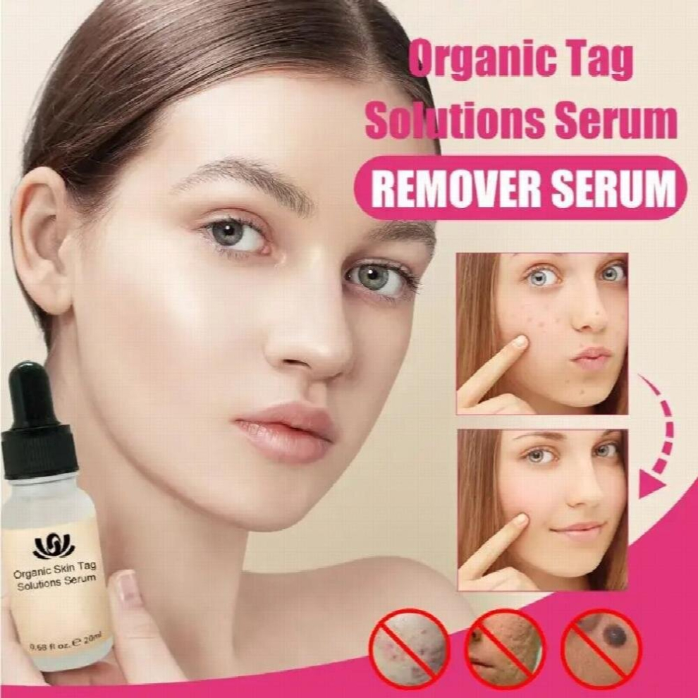 Multicoloured Organic Skin Spot Purifying Serum Tag Remover Serum Organische Tag Remover Serum Wart Tag Mole Store