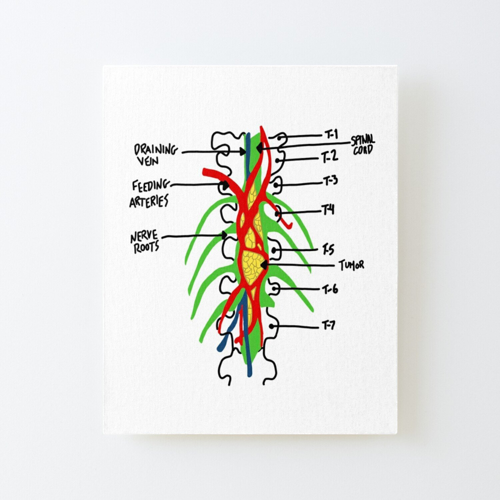 Canvas Print Only grey's anatomy tumor Poster Wall Art Room Decor 16x20 inch No Frame