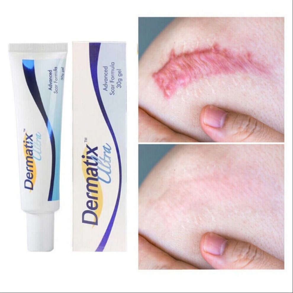 DermatixÂ® Ultra Lightens, softens and flattens scars 15g