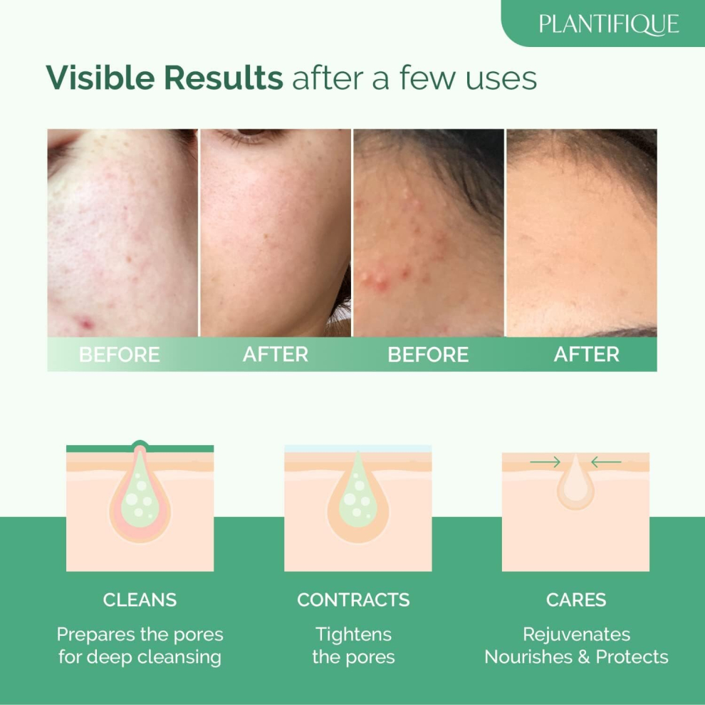 FaceMasks Skincare KoreanOrganic ClayMask 100%Vegan Avocado&GreenTea