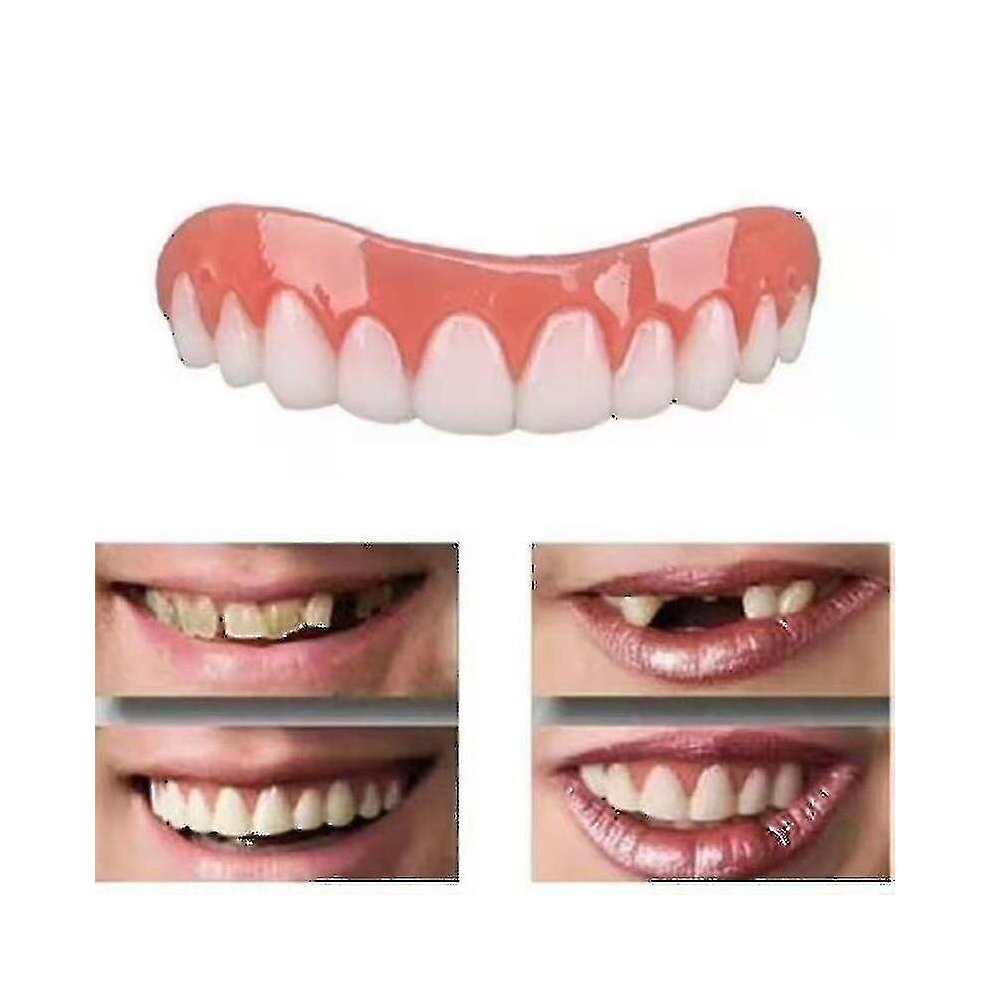 2 Sets Of Dentures, Upper And Lower Jaw Dentures, Natural And Comfortable, Protect The Teeth, And Regain A Confident Smile