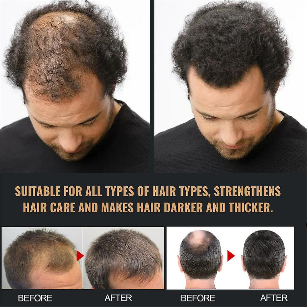 Black Anti Baldness Shampoo Fast Thicker Dense Deep Cleansing Follicles Strengthen Hairs Root Activating Nourish Hair Regrowth Shampoo