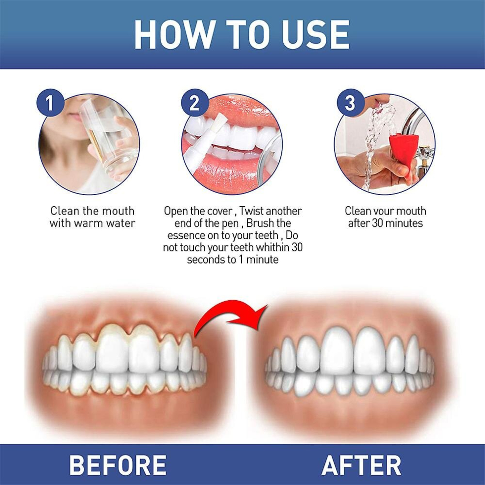 New Dentizen Gum Therapy Gel Gum Instant Soothing Gels For Sensitive Teeth Pen -new