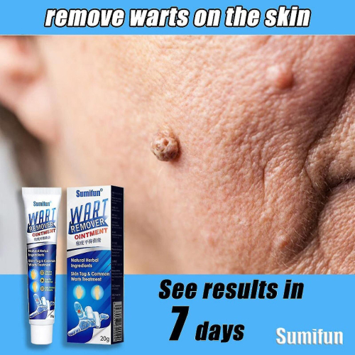 Molluscum Contagiosum Removal L Antil 1