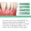 Dentizen Gum Regrowth Drops 2