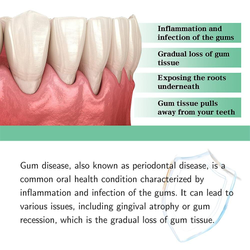 Dentizen Gum Regrowth Drops 1