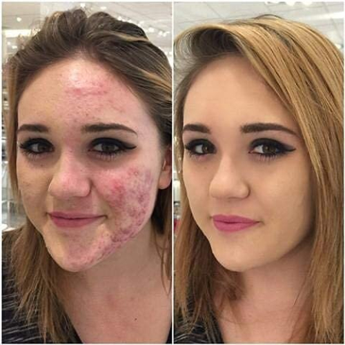Phoera Foundation Full Coverage Makeup Set - 24hr Long Lasting Oil Control - Same Foundation Smarter Packaging (104 Buff Beige) 2