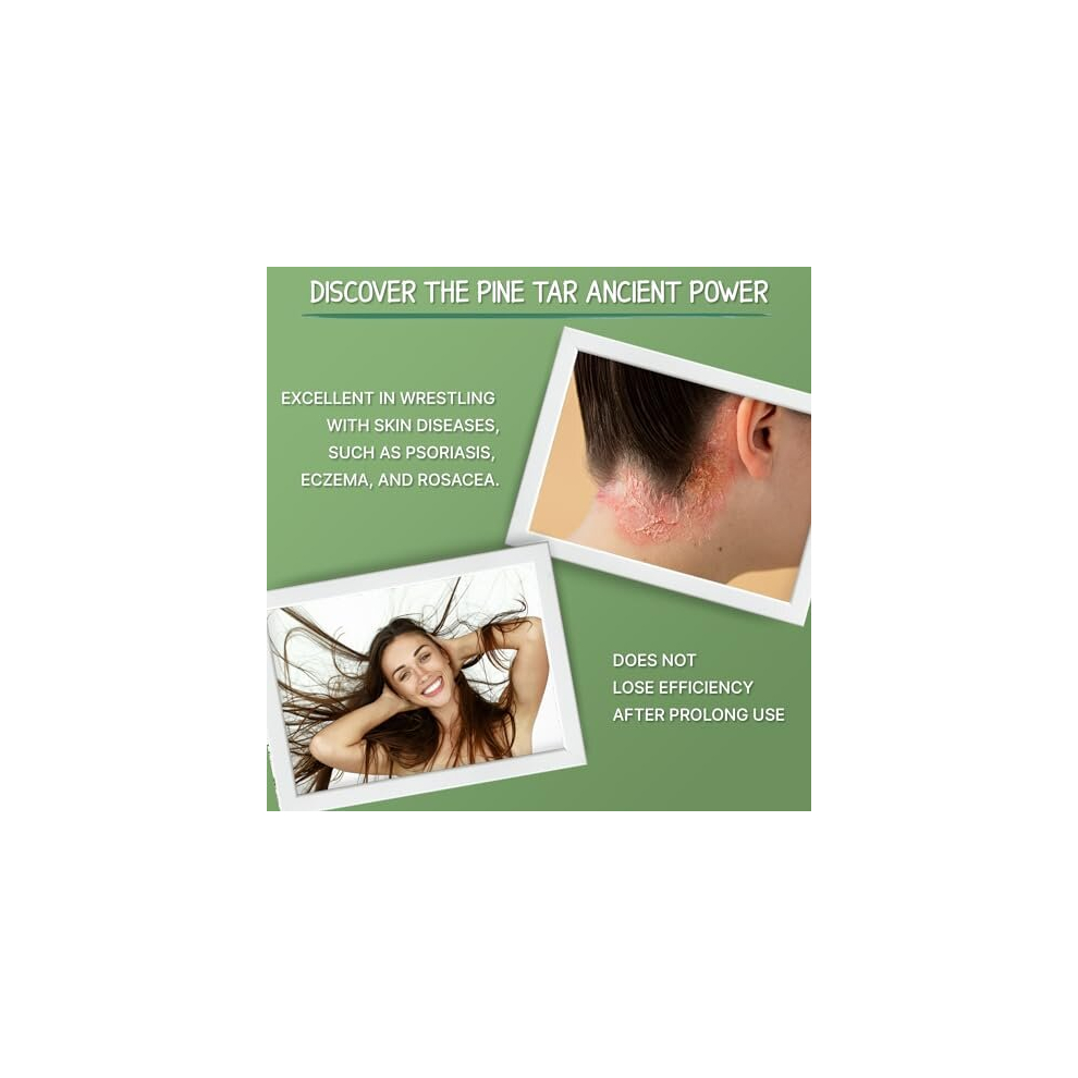 Pine Tar Shampoo for Seborrheic Dermatitis 500ml Natural Dandruff