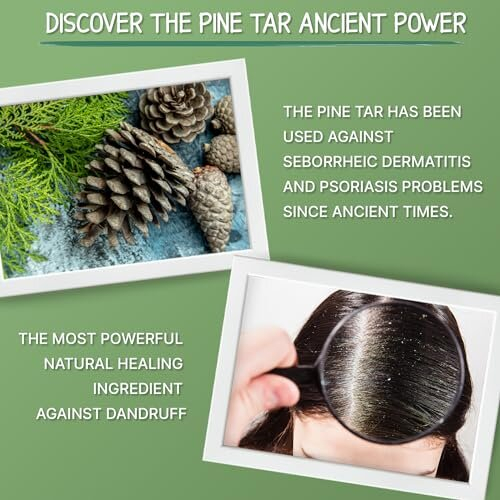 Pine Tar Shampoo for Seborrheic Dermatitis 500ml Natural Dandruff