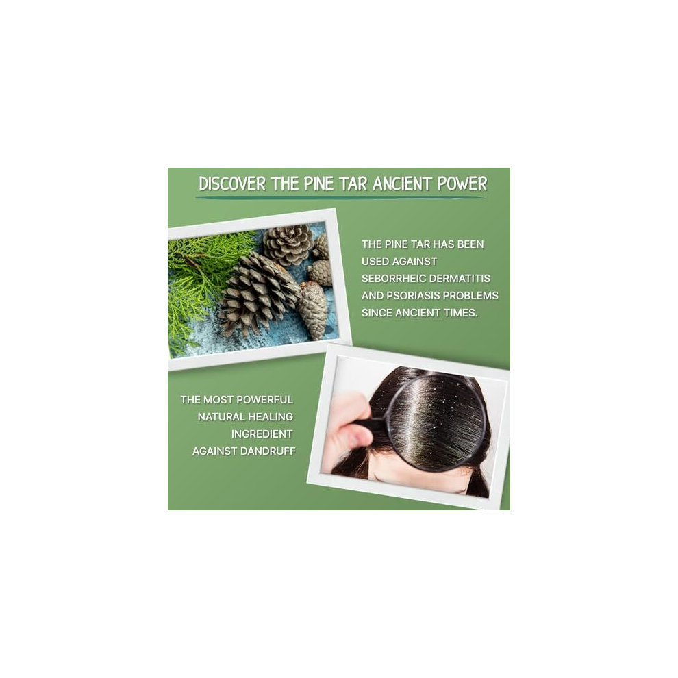 Pine Tar Shampoo for Seborrheic Dermatitis 500ml Natural Dandruff