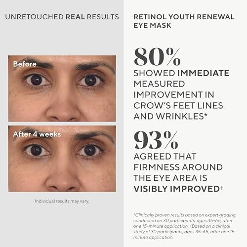Murad Retinol Youth Renewal Eye Mask 2