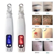 Home Portable Picosecond Tattoo Removal Pen Fit For Mole Dark Spot Acne Scar -ys