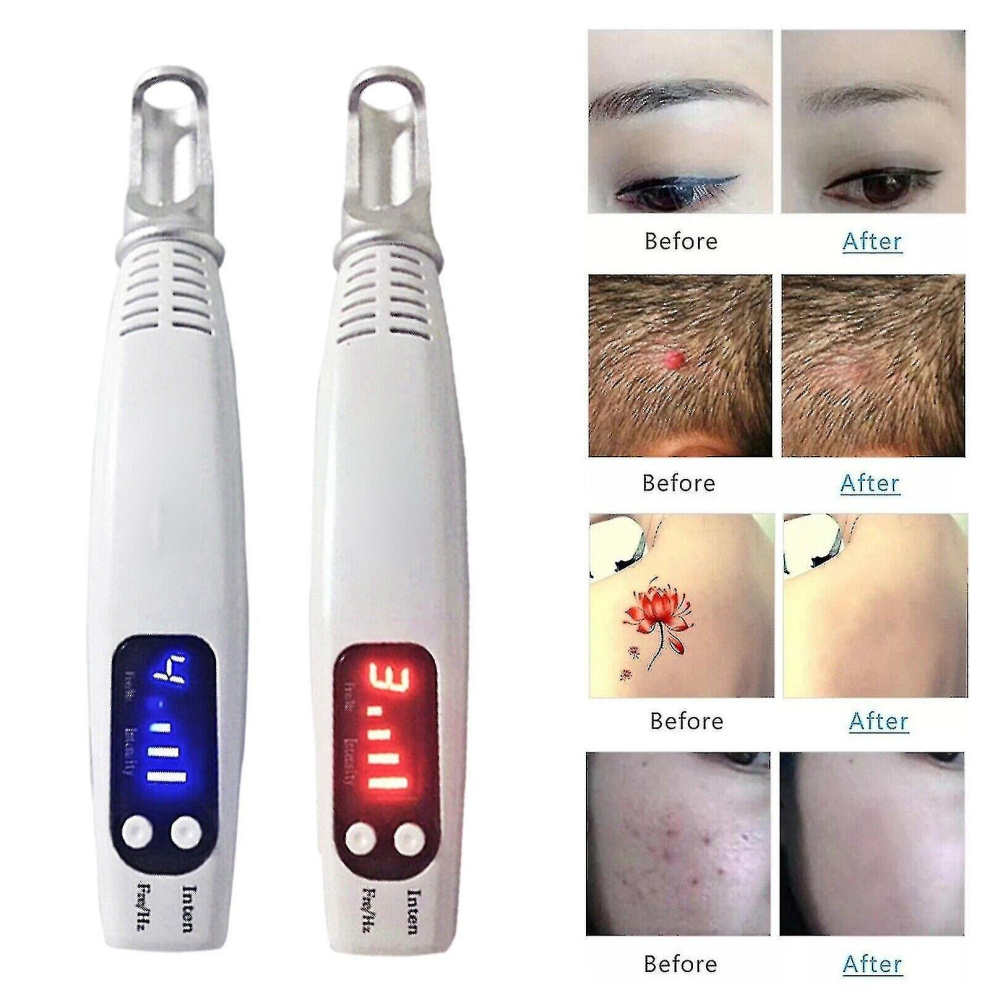 Home Portable Picosecond Tattoo Removal Pen Fit For Mole Dark Spot Acne Scar -ys