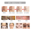 (0.5mm) Derma Microneedle Roller 180 Titanium Micro Needles Rollers Mesotherapy Microagulhamento Therapy Skin Care Tool 4