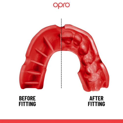 OPRO UFC KIDS SILVER SELF FIT MOUTH GUARD - BLACK 1