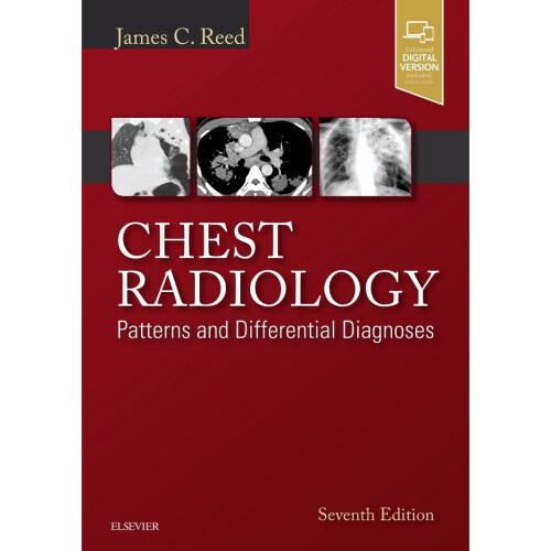 Chest Radiology: Patterns and Differential Diagnoses, 7e